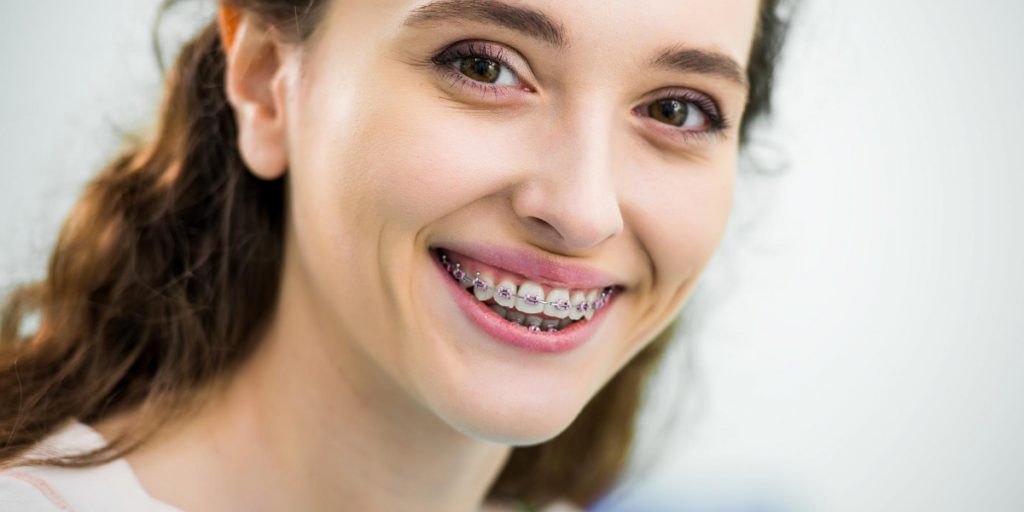 Tipos y precios de la ortodoncia en adultos