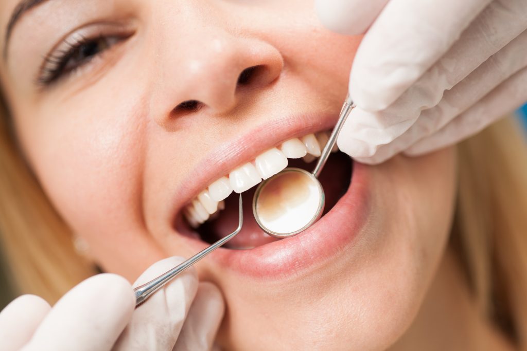 El esmalte dental: qué es, cómo cuidarlo y qué lo desgasta