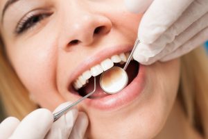 esmalte dental