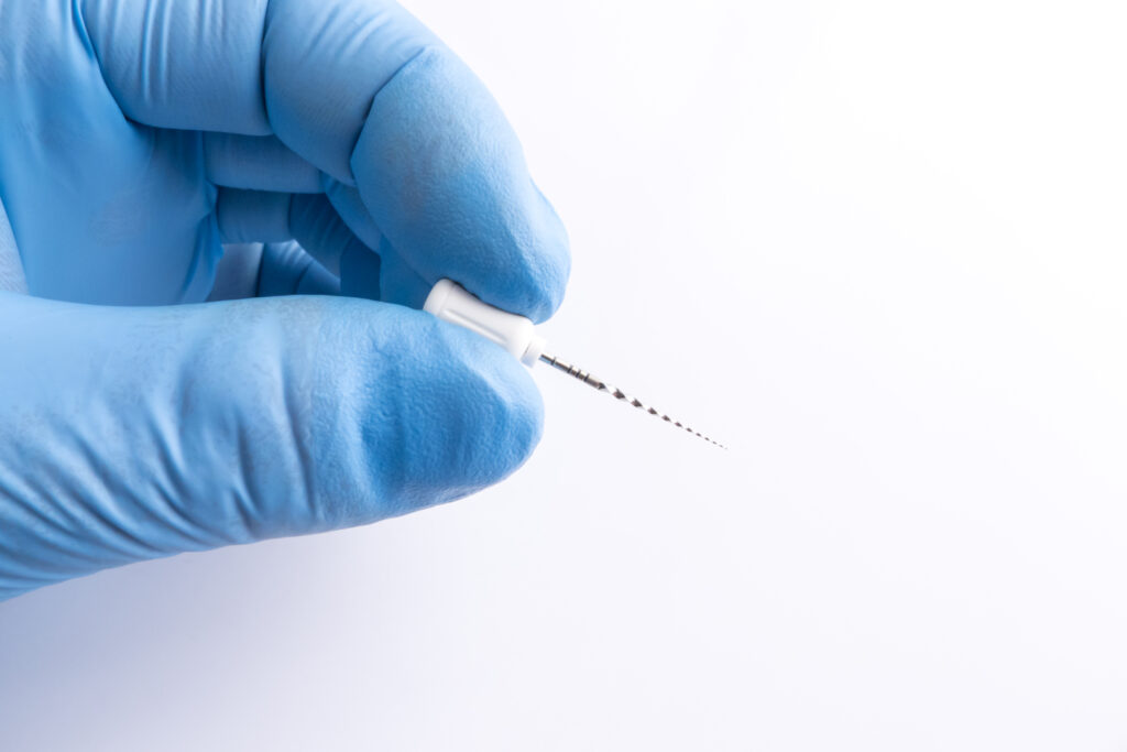 Cuánto dura una endodoncia y qué resultados tiene